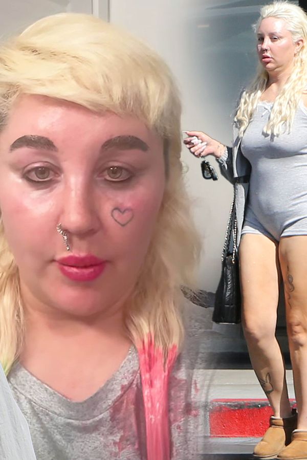 Hurá! Amanda Bynes už nemá slimáky místo obočí a hodně prokoukla. Fanoušci nevěří svým očím - fotka 1/1