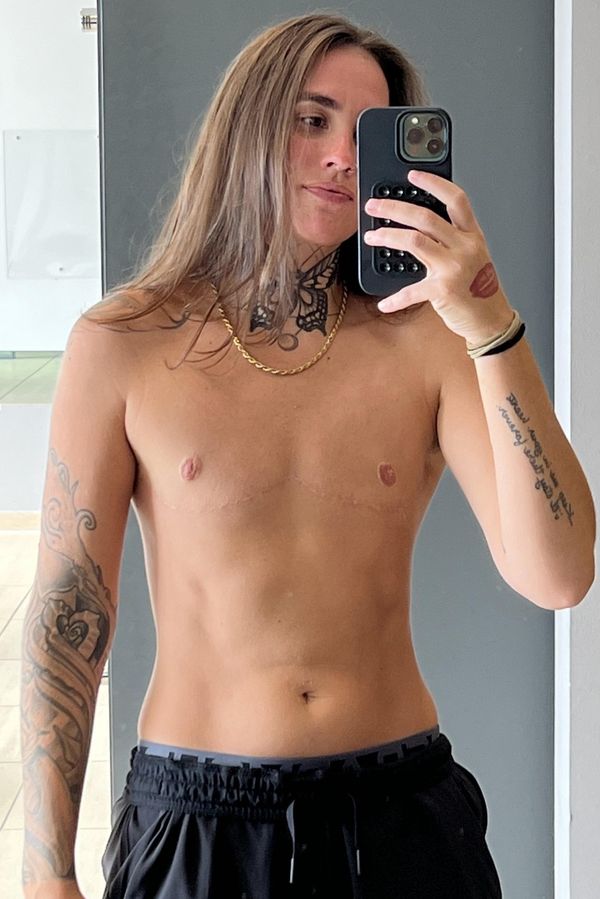 Žena si nechala odstranit prsa, protože je prostě nechtěla. Lidé jí píšou, ať se jde zabít  - fotka 1/1
