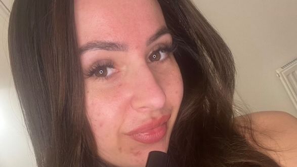 Dítě ji v obchodě ponížilo kvůli akné. Po třech letech trápení konečně zahodila make-up