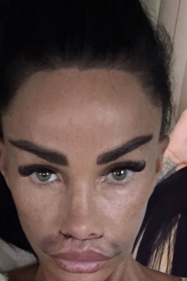 Katie Price začaly ‚cestovat‘ výplně rtů: Podívejte, jak nyní vypadá! - fotka 1/1