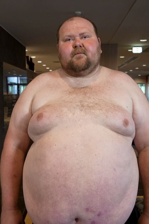 Váží 218 kilo a bojí se smrti! Morbidně obézní Peter z Extrémních proměn je v pasti. Kvůli váze ho nemůžou operovat