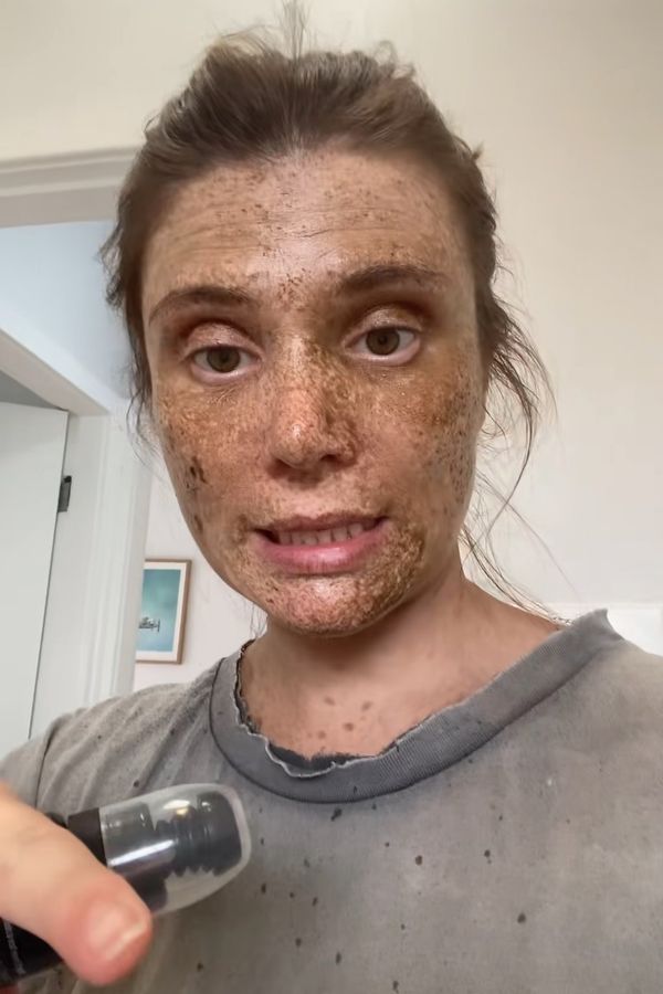 Chtěla bronzové opálení, skončila s flekatým obličejem! Virální video donutilo kosmetickou značku ke změně - fotka 1/1