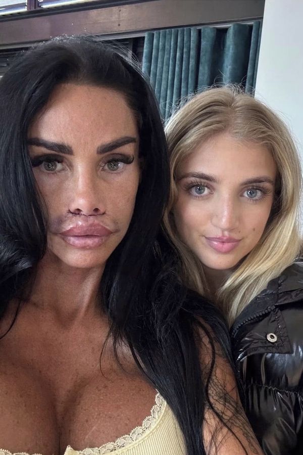 Katie Price způsobila dceři šok, když se jí ukázala po posledním zákroku: Je to nechutný! neudržela se Princess - fotka 1/1
