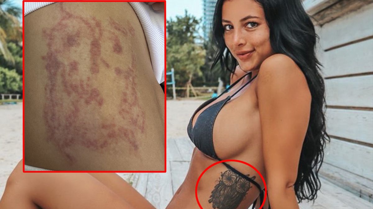 Tahle sovička vyšla sexy fitnesku hodně draho! Její odstranění už ji stálo 300 tisíc i vztah s tátou. A stále není hotovo!