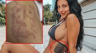 Tahle sovička vyšla sexy fitnesku hodně draho! Její odstranění už ji stálo 300 tisíc i vztah s tátou. A stále není hotovo!