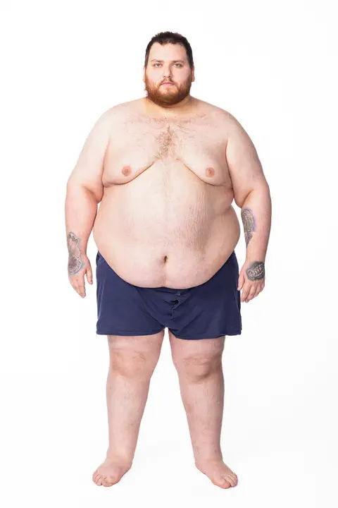 Morbidně obézní Marián váží děsivých 229 kilo a je závislý na sladkostech. Takhle vypadá, když se svlékne