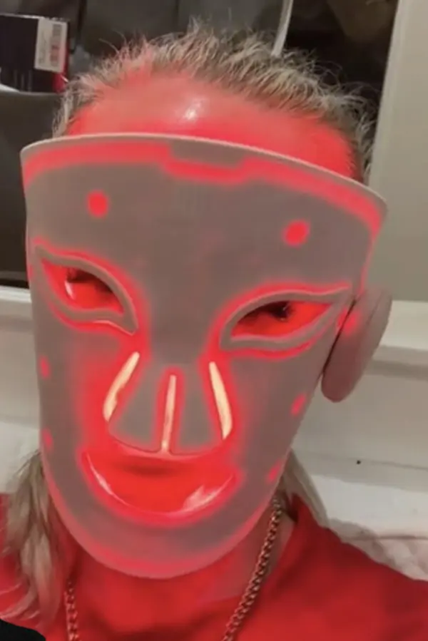 Botox odmítla, povadlou pleť vypnula za 170 korun. Proměna je tak výrazná, že se mě lidé ptají na plastiku, směje se - fotka 1/1