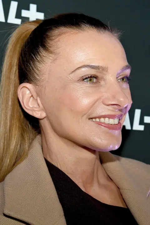 Alice Bendová po 6 týdnech od plastiky poprvé na veřejnosti: Podívejte se na její jizvy bez retuše. Plánuje další zákrok