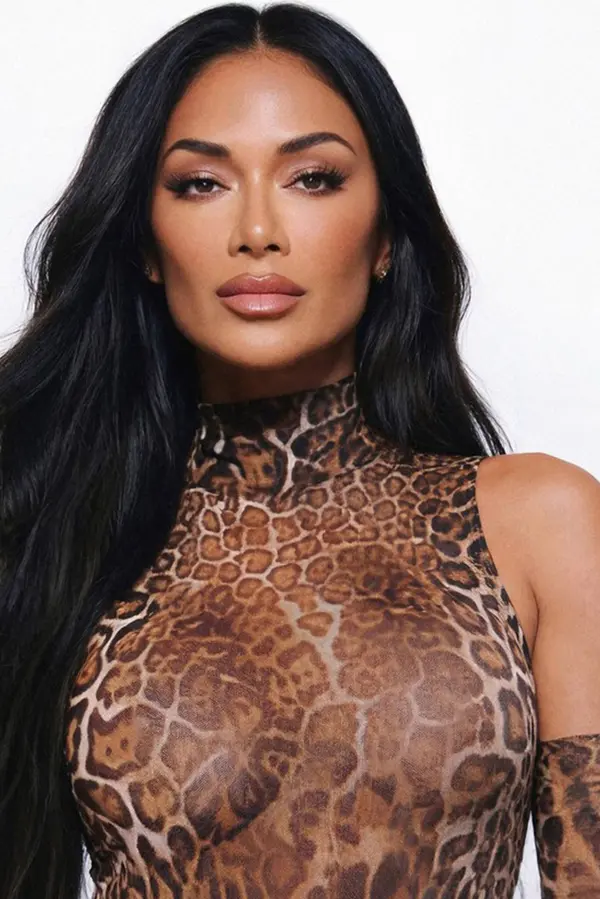 Popáleniny Nicole Scherzinger nelze přehlédnout: Připomínají ‚tetování afrického kmene‘ - fotka 1/1