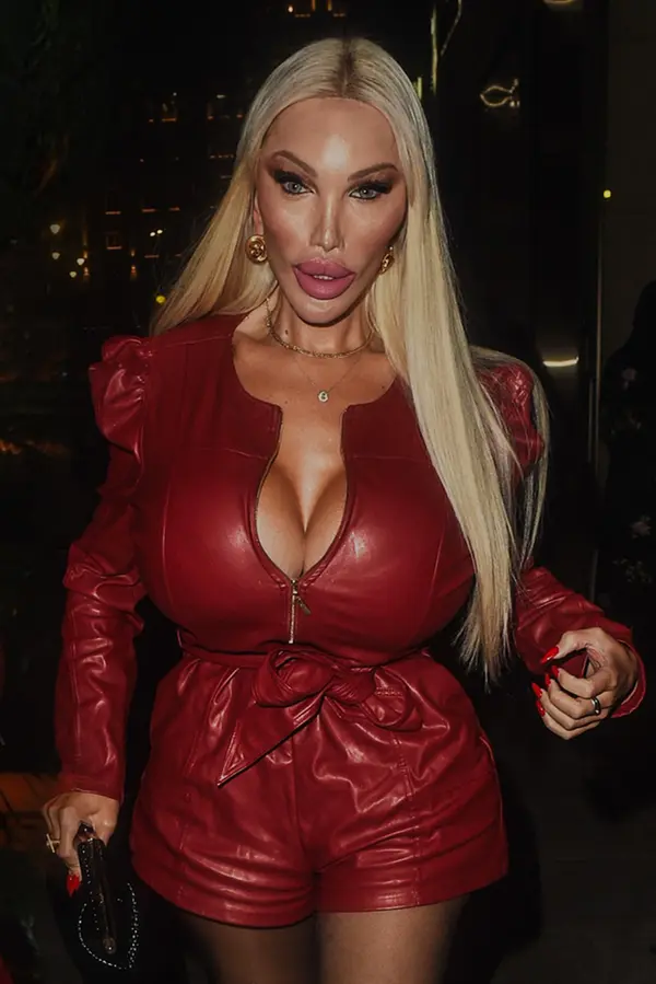Jessica Alves se změnila téměř k nepoznání. Obří silikony a nekonečné plastiky zcela proměnily její vzhled  - fotka 1/1